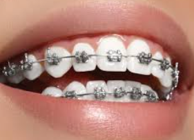 ORTHODONTIC